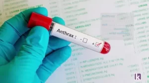 FG informs Nigerians about anthrax outbreak in Zamfara.